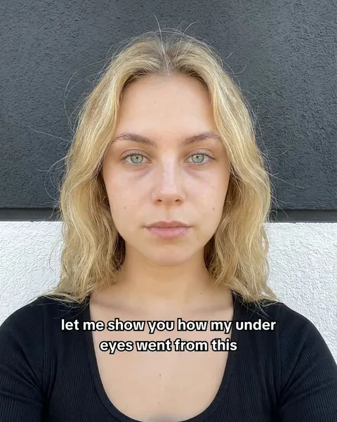 TikTok slideshow cover: Under eye transformation