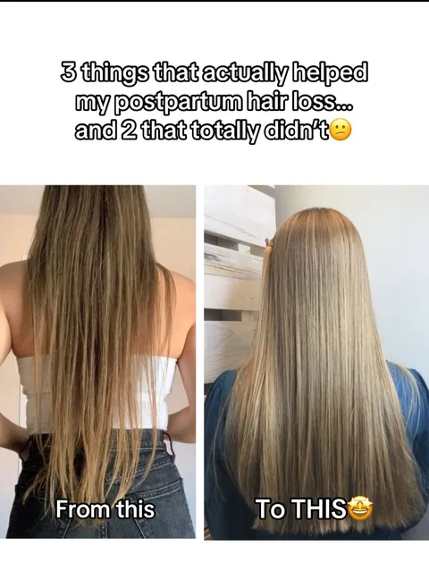 TikTok slideshow cover: Postpartum hair loss tips