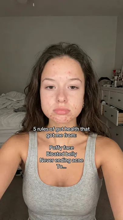 TikTok slideshow cover: 5 rules of gut health