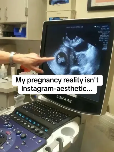 TikTok slideshow cover: My pregnancy reality isn't Instagram-aesthetic...