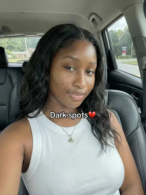 Original slideshow: Addressing Dark Spots
