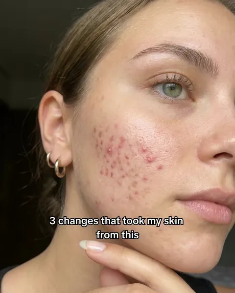 TikTok slideshow cover: 3 changes that took my skin from this