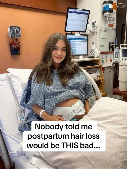 TikTok slideshow cover: Postpartum hair loss