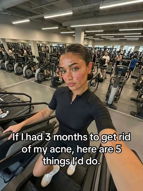 Original slideshow: If I had 3 months to get rid of my acne, here are 5 things I'd do.