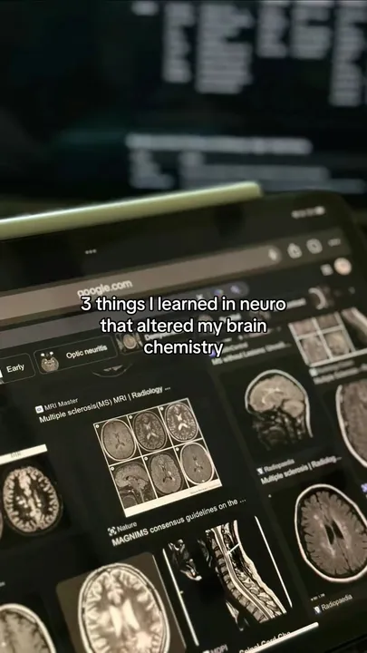 TikTok slideshow cover: 3 things I learned in neuro that altered my brain chemistry