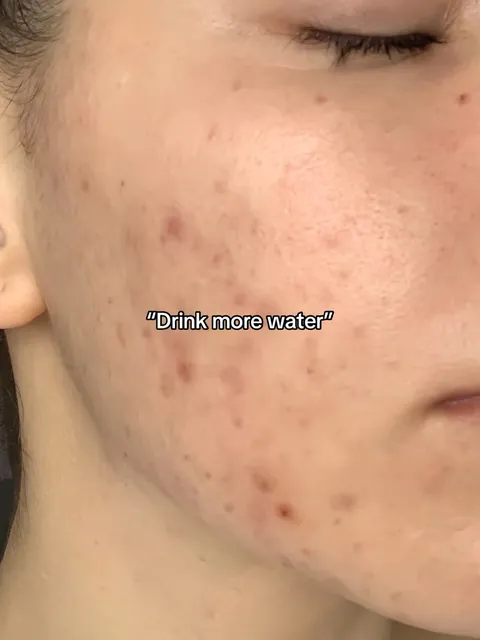 TikTok slideshow cover: "Drink more water"