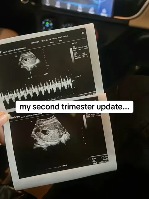 TikTok slideshow cover: My second trimester update