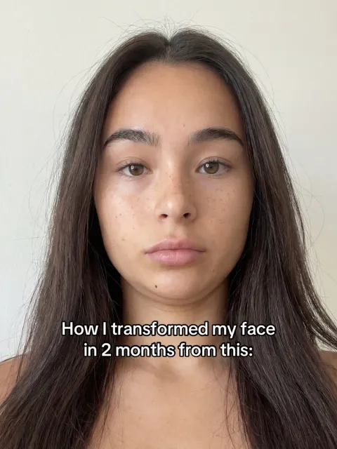 TikTok slideshow cover: How I transformed my face in 2 months from this:
