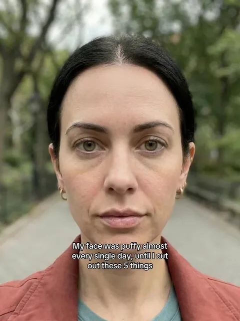 Original slideshow: Reducing Facial Puffiness
