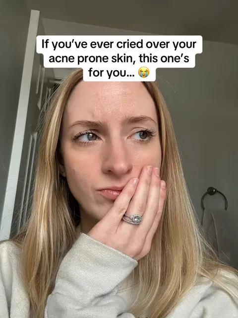 TikTok slideshow cover: Acne prone skin advice