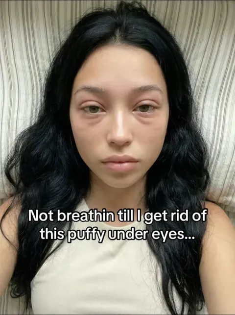 TikTok slideshow cover: Getting rid of puffy under eyes