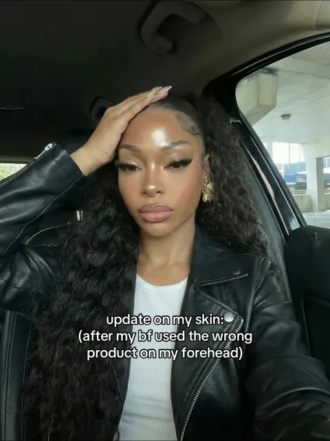 TikTok slideshow cover: update on my skin: (after my bf used the wrong product on my forehead)
